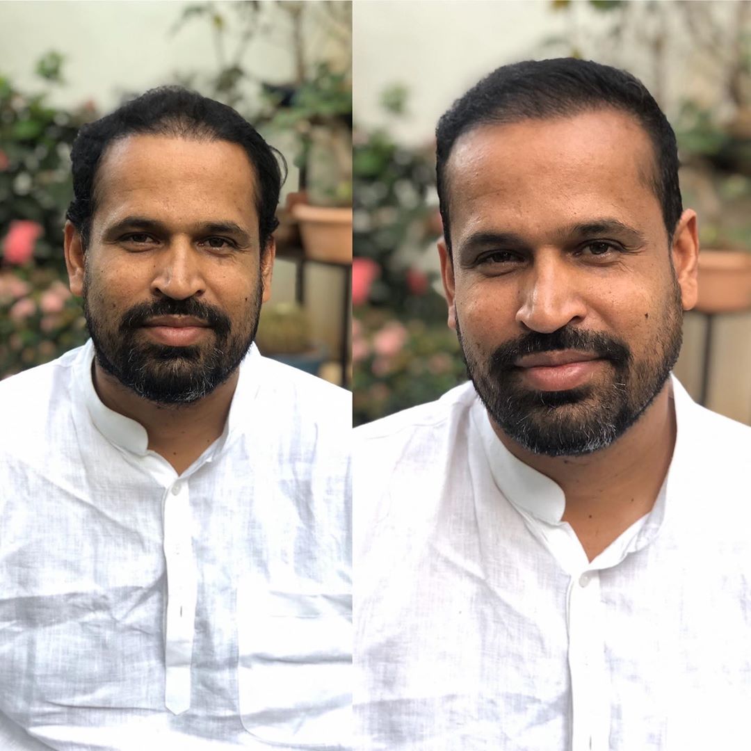Yusuf Pathan 'Before and After' | Instagram
