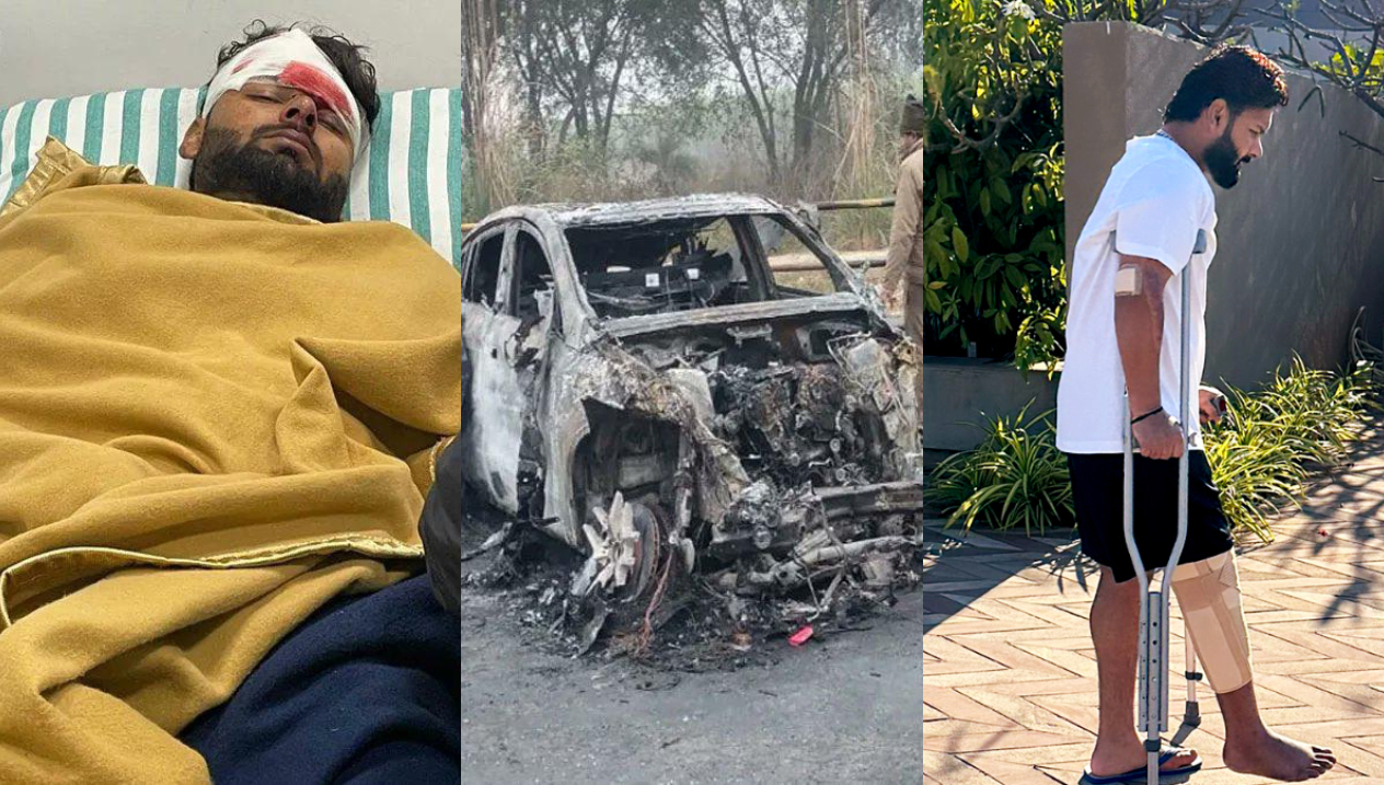 Rishabh Pant injuries after car accident and recovery | X