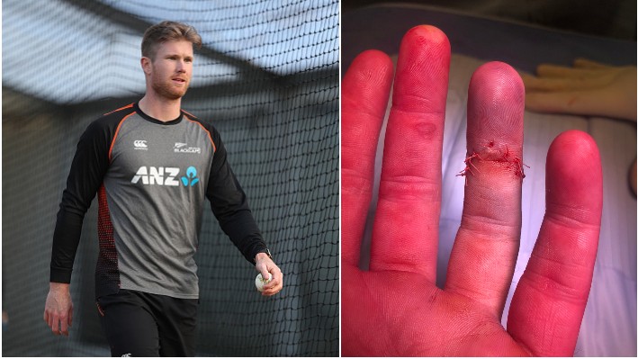 New Zealand all-rounder Jimmy Neesham undergoes finger surgery 