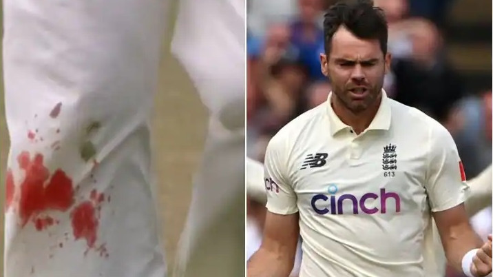 ENG v IND 2021: James Anderson bowls with a bloodied knee; Fans hail his dedication on Twitter