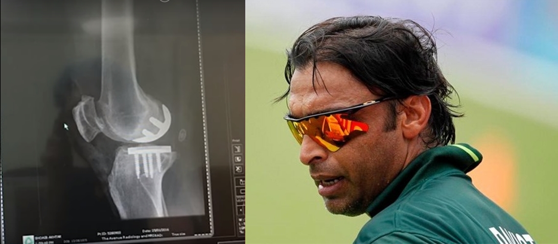 Shoaib Akhtar is set to undergo knee replacements on both knees | Twitter