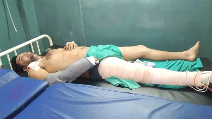 Lalit Bhandari had operations to both his hand and a leg after accident | himalsanchar.com