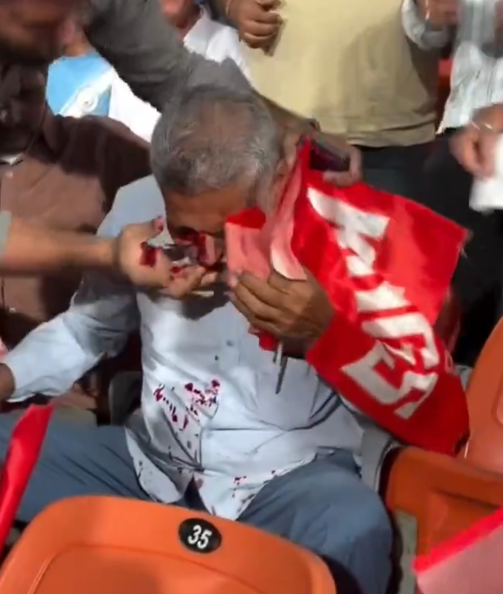 PBKS fan suffered a bloodied face after being hit by the ball | X