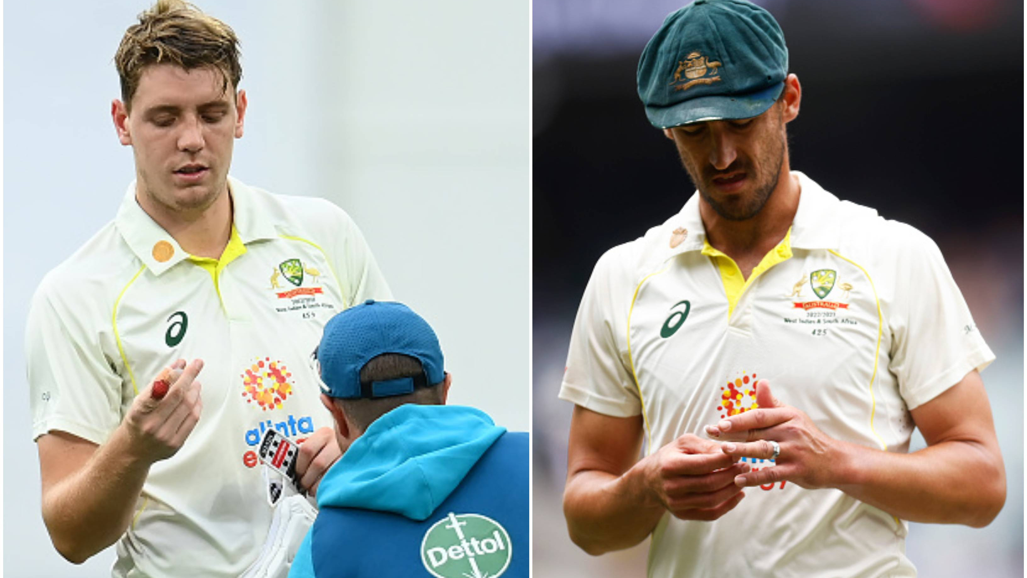 AUS v SA 2022-23: Cameron Green to undergo finger surgery; Starc racing against time to be fit for opening Test vs India