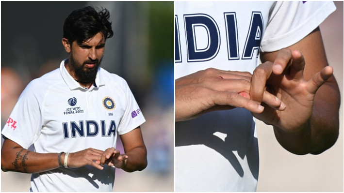 ENG v IND 2021: Ishant Sharma gets stitches on bowling hand, likely to recover before Test series