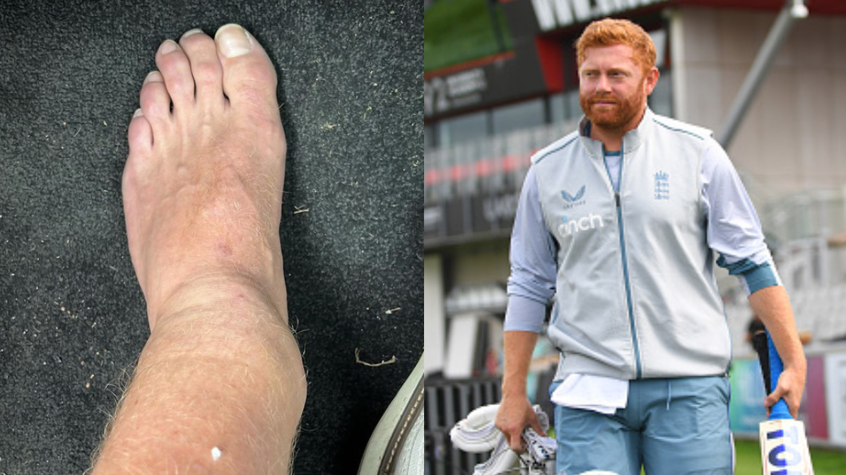 Jonny Bairstow opens up on his horrific leg injury, says he wondered if he would ever be able to 'walk again'