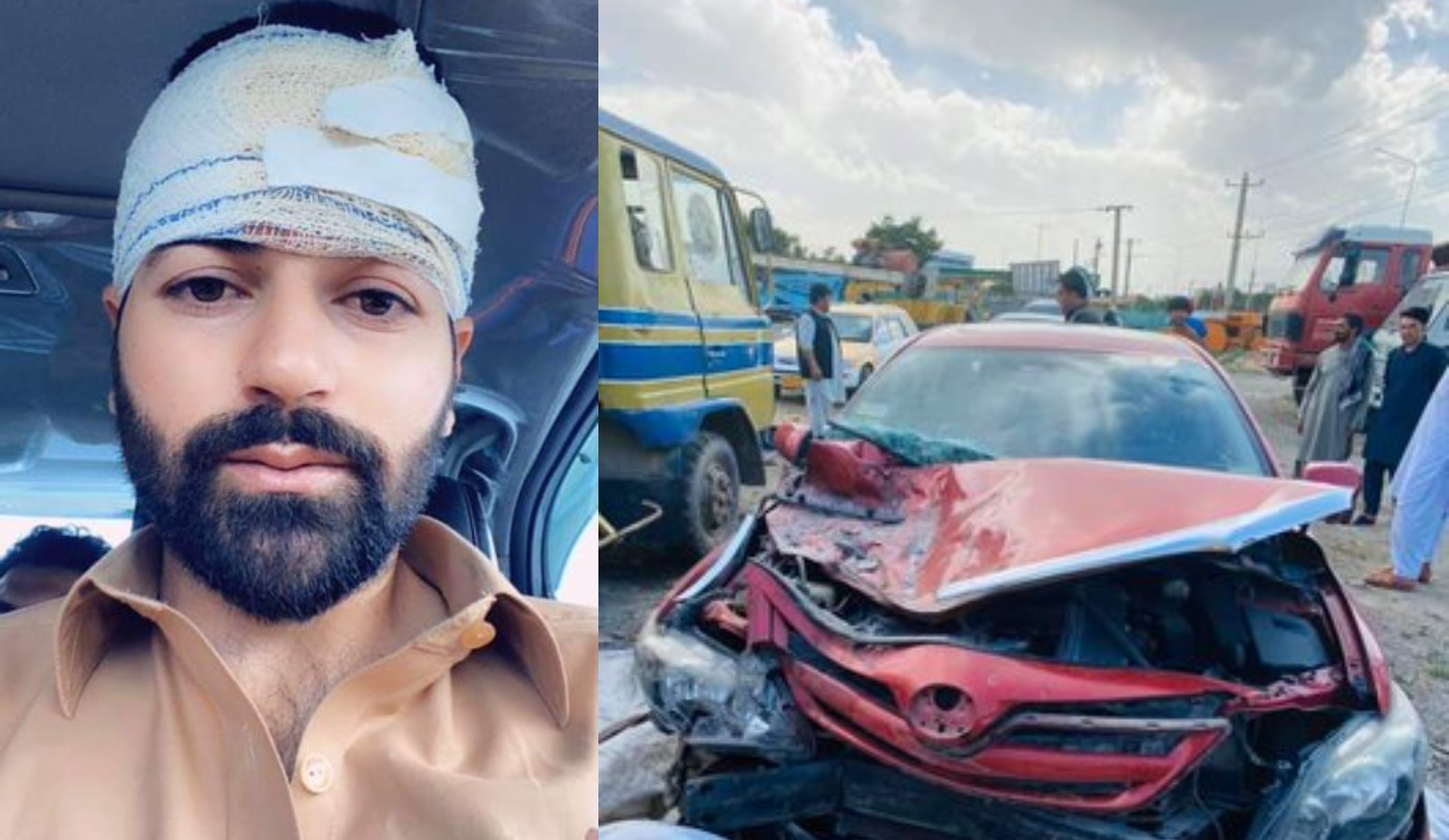 Afsar Zazai survived a horrific car accident | Twitter