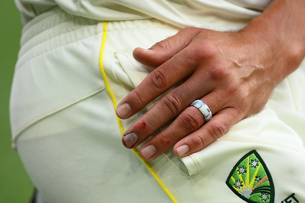 Mitchell Starc hurt his finger during MCG Test vs South Africa | Getty