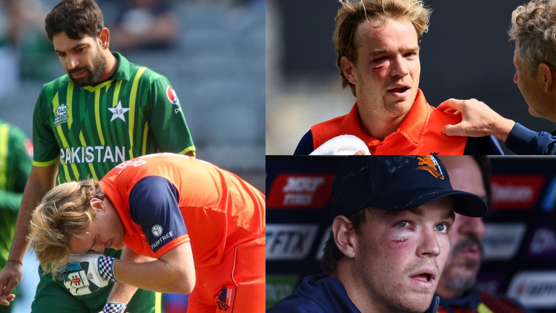 T20 World Cup 2022: WATCH- Bas de Leede gets hit in the face by a Haris Rauf bouncer; suffers concussion
