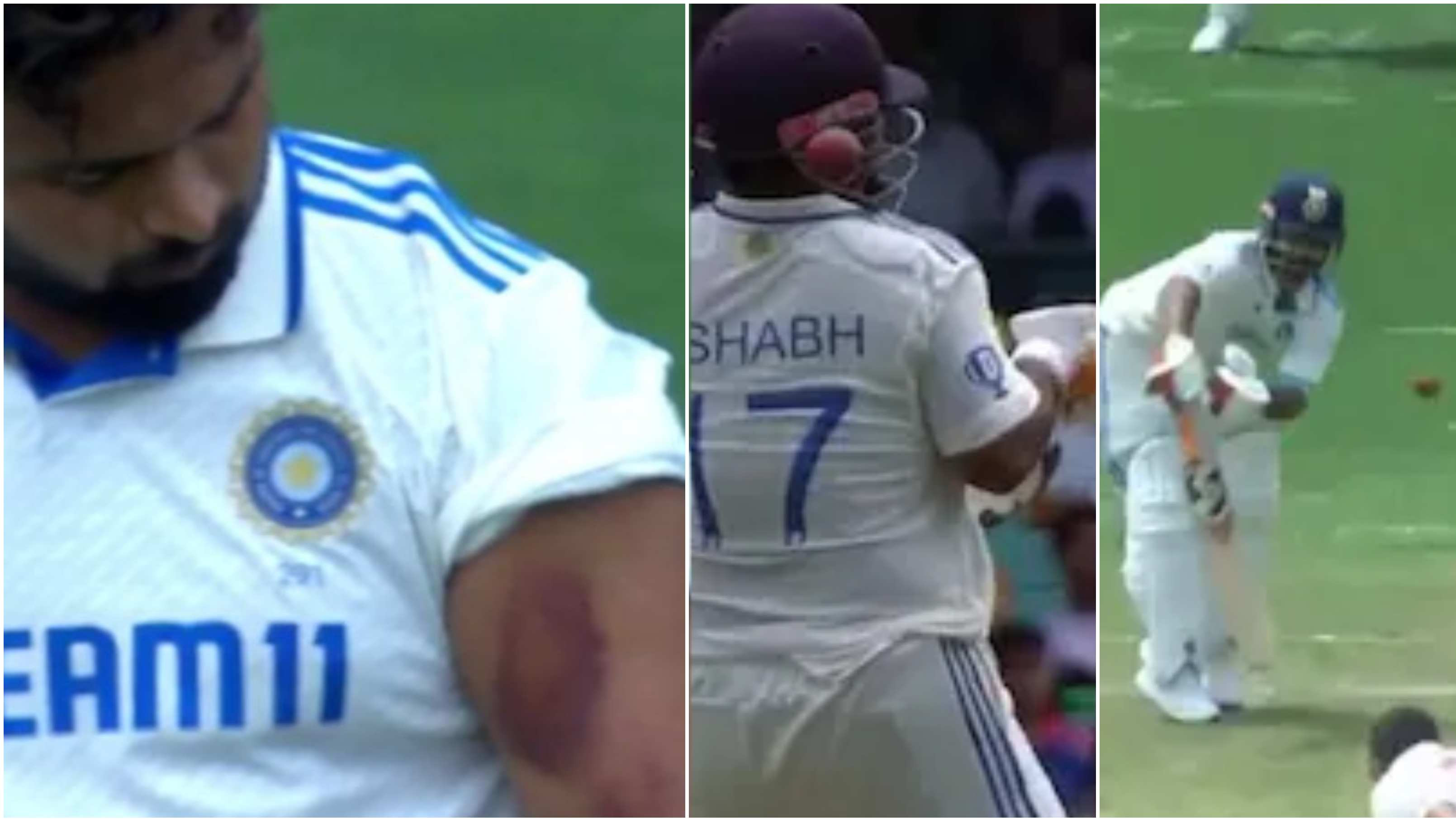 BGT 2024: WATCH – Rishabh Pant suffers bruise on his bicep; takes a blow on helmet grill and midriff during Sydney Test