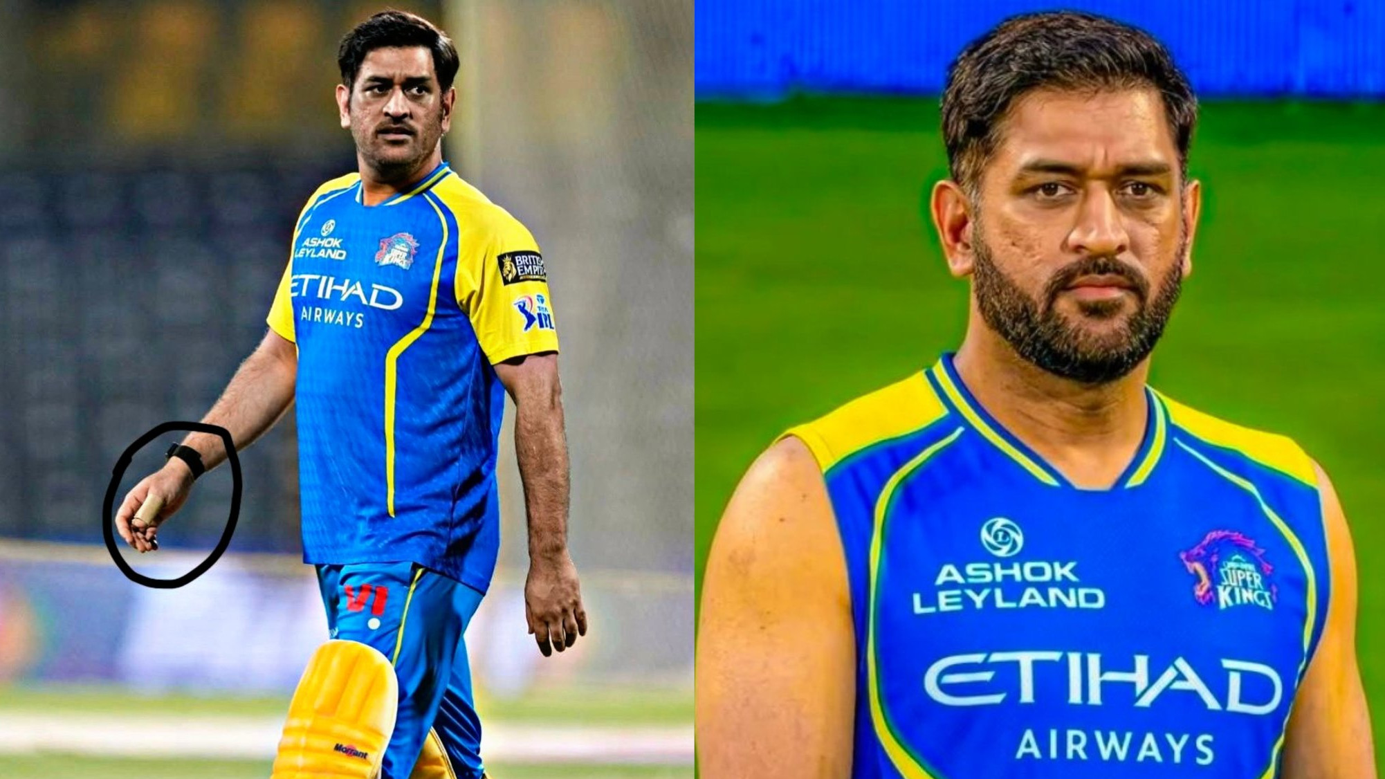 IPL 2026: MS Dhoni suffers thumb injury; unlikely to play for CSK against SRH in Chepauk- Report
